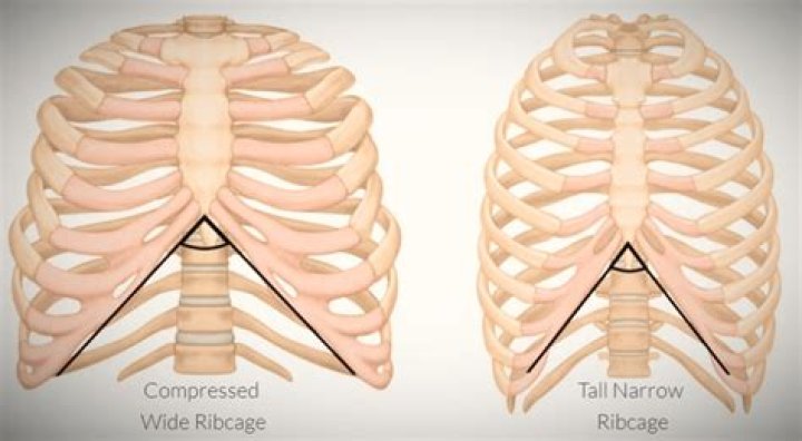 Can your rib cage get bigger?